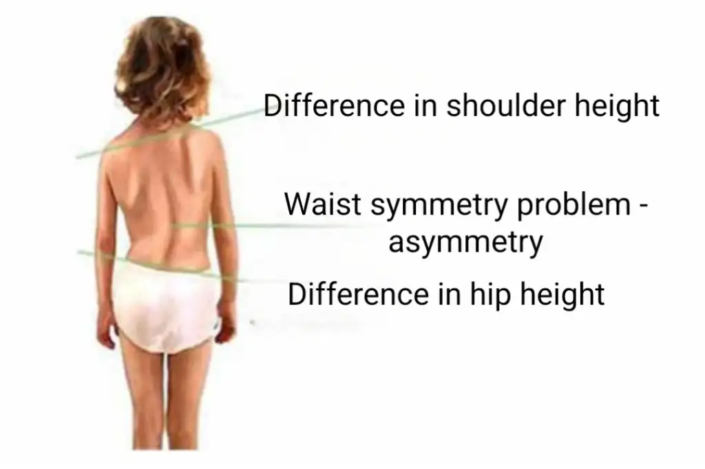 Pediatric Spine Problems