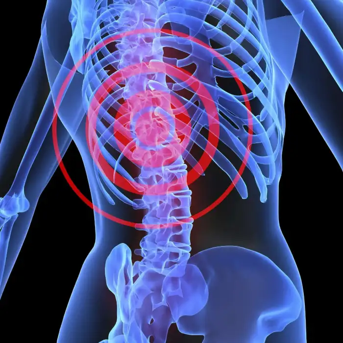 SPORTS SPINE INJURIES