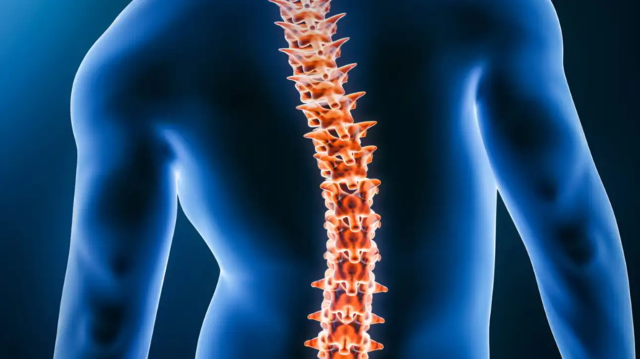 Surprising facts you need to know about adult scoliosis,scoliosis spine problems,Scoliosis surgery