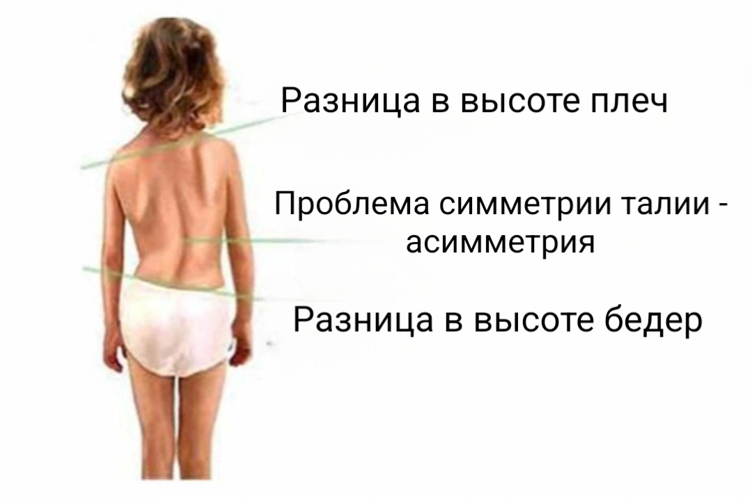 Детские проблемы с позвоночником
